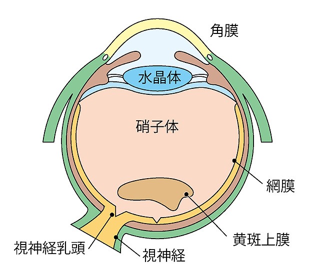 黄斑上膜とは